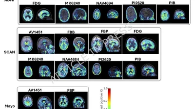 Automated PET tracer classification in multi-site, multi-cohort studies using deep learning featured image